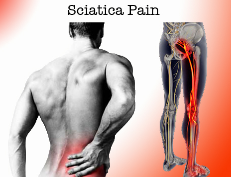 sciatica 5 resized 600.jpg